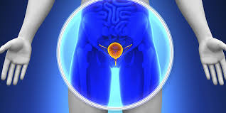 Urology Investigations
